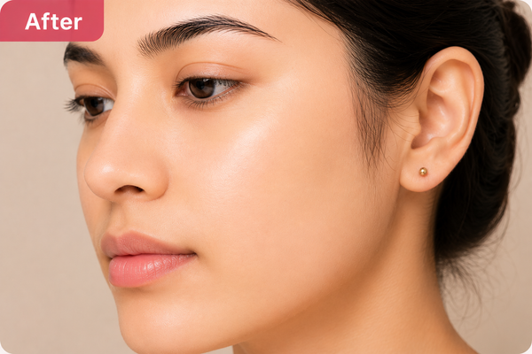 Orange Enzymes Brightening Gel - After