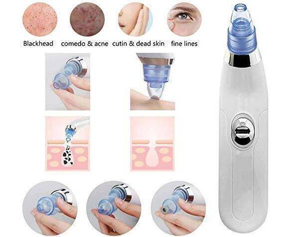 Blackhead Removal Machine | 5 in 1
